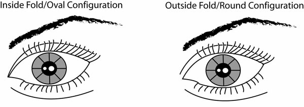 Asian Face Tutorial Dallas | Facial Surgery Info Plano