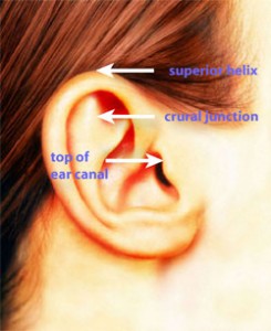 Otoplasty Tutorial Dallas | Ear Surgery Information Plano